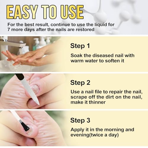 Toenail Fungus Treatment Extra Strength 30ml D405167